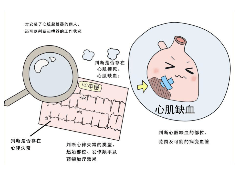 動態腦電圖的注意事項_做動態腦電圖注意事項_做動態腦電時注意什么