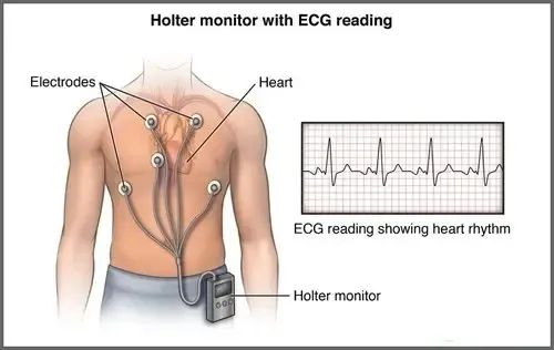 做動態腦電圖需要準備什么_做動態腦電圖對人體有傷害嗎_做動態腦電圖注意事項